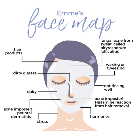 face chart for acne